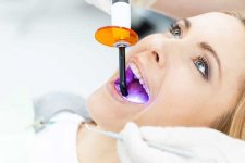 Brighten & Beam: Ultimate Jiahui Teeth Whitening Deal
