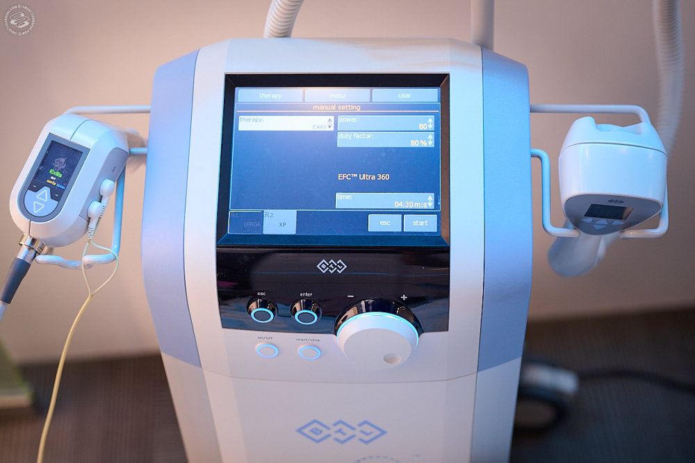 Skin Tightening with the Exilis Ultra 360  
