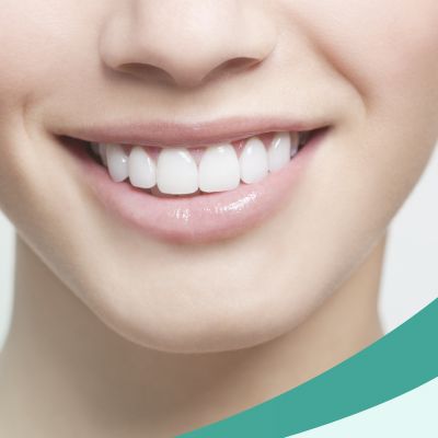 Jiahui Health Professional Teeth Whitening 