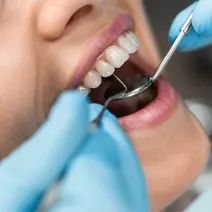 Dental Care Without the Insurance Circus: Parkway’s Flat-Fee Membership Plans